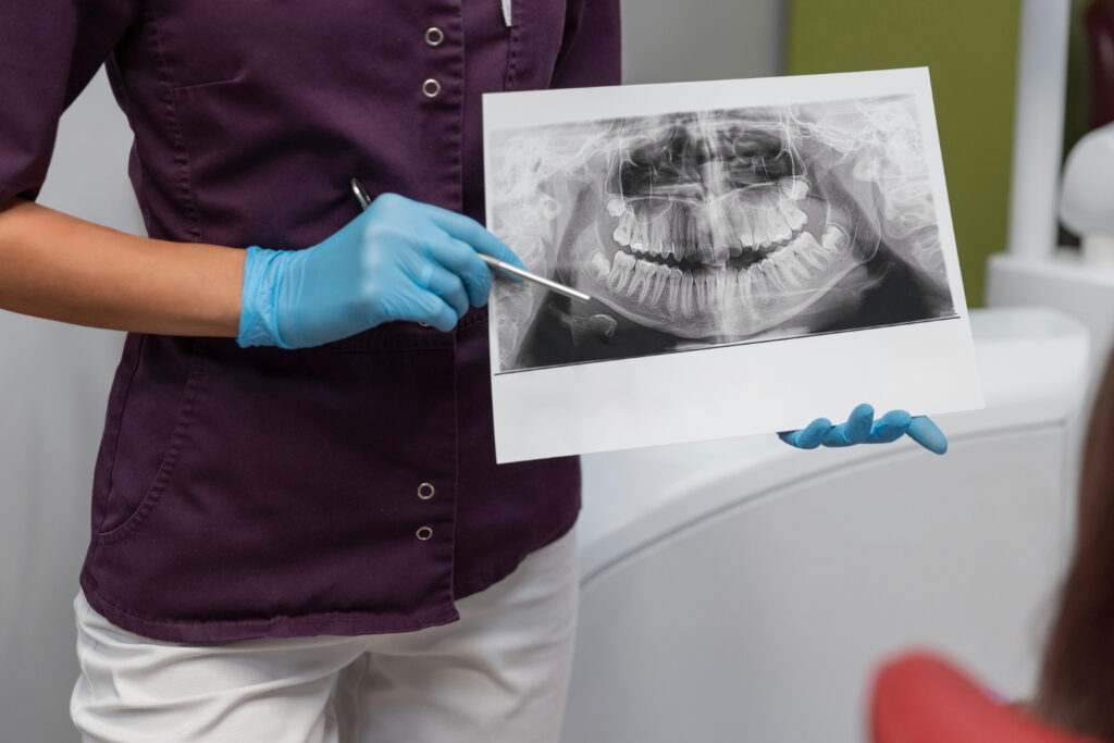 Radiologia Odontológica em Criciúma: Tudo o que Você Precisa Saber