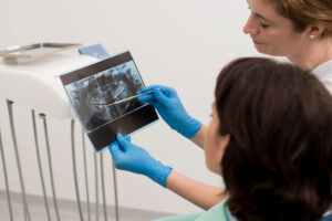 Conheça as Principais Diferenças Entre Tomografia e Radiografia Dentária