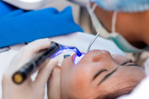 5 Benefícios do Escaneamento Intraoral
